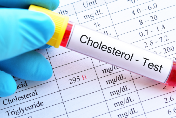 Cholesterol Na Czym Polega Badanie Normy Wskazania Przygotowanie 131072 Hot Sex Picture 4874