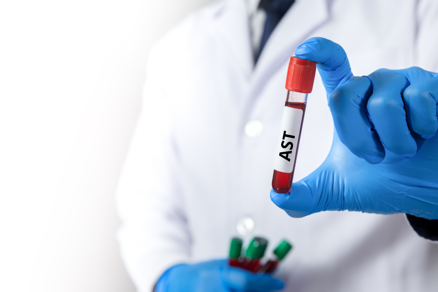 Badanie AST — na czym polega i kiedy je wykonać? Przygotowanie, normy i ...