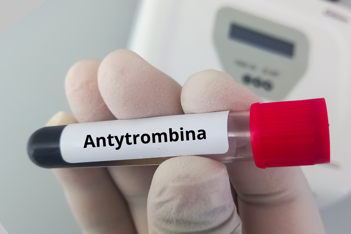 Antytrombina — Na Czym Polega Badanie I Kiedy Je Wykonać Przygotowanie Normy I Interpretacja 6288