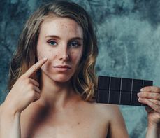 Dieta przy trądziku młodzieńczym − podstawowe zalecenia żywieniowe