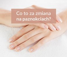 Wygląd paznokci a zdrowie, czyli o czym informują nas zmiany na paznokciach