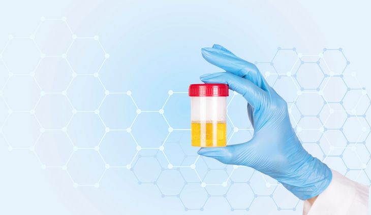 Oznaczenie izoenzymów transferazy umożliwia określenie poziomu uszkodzenia komórek cewek nerkowych / Fot. Adobe Stock