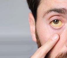 Bilirubina – co to jest? Podział bilirubiny i przyczyny zbyt wysokich wyników