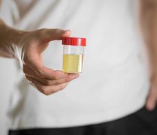 Białkomocz – jakim chorobom towarzyszy? Białkomocz w ciąży, normy dla białka w moczu