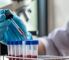 Test na obecność wirusa HIV – jaka jest cena, czy są darmowe badania, czy trzeba być na czczo?