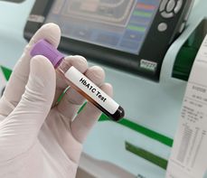 Oznaczenie hemoglobiny glikowanej (HbA1C) – na czym polega badanie? Normy, wskazania, przygotowanie