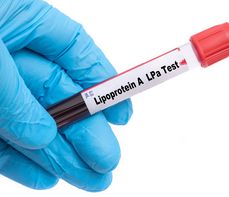 Lipoproteina – na czym polega badanie? Normy, wskazania, przygotowanie