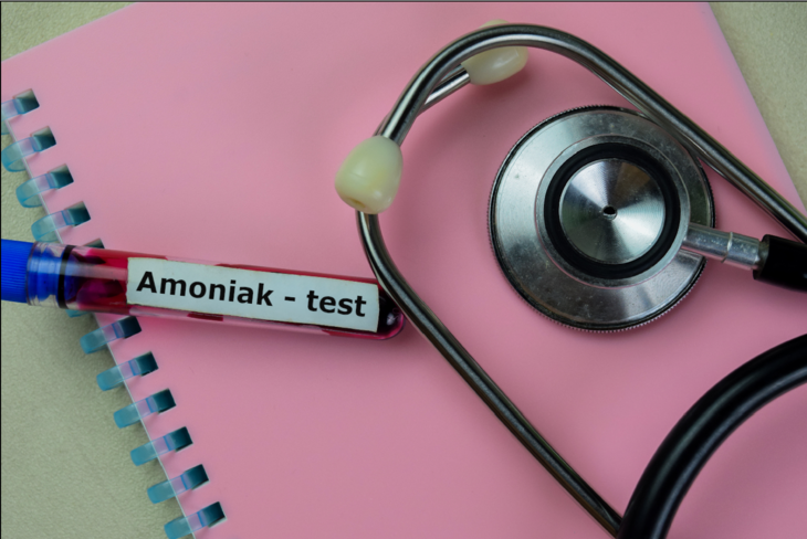 Amoniak — Na Czym Polega Badanie I Kiedy Je Wykonać Przygotowanie Normy I Interpretacja Wyników 2611