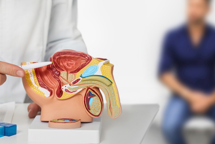 Biopsja prostaty należy do najczęstszych badań diagnostycznych w kierunku rozwoju raka stercza – prostaty. /Fot. Adobe Stock
