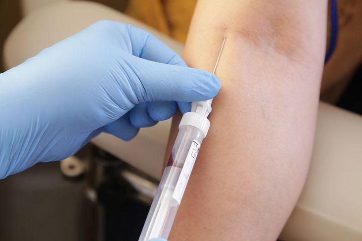 Gamma-globuliny to białka odpornościowe, do których zalicza się immunoglobuliny klasy IgA, IgM oraz IgG. /Fot. Adobe Stock