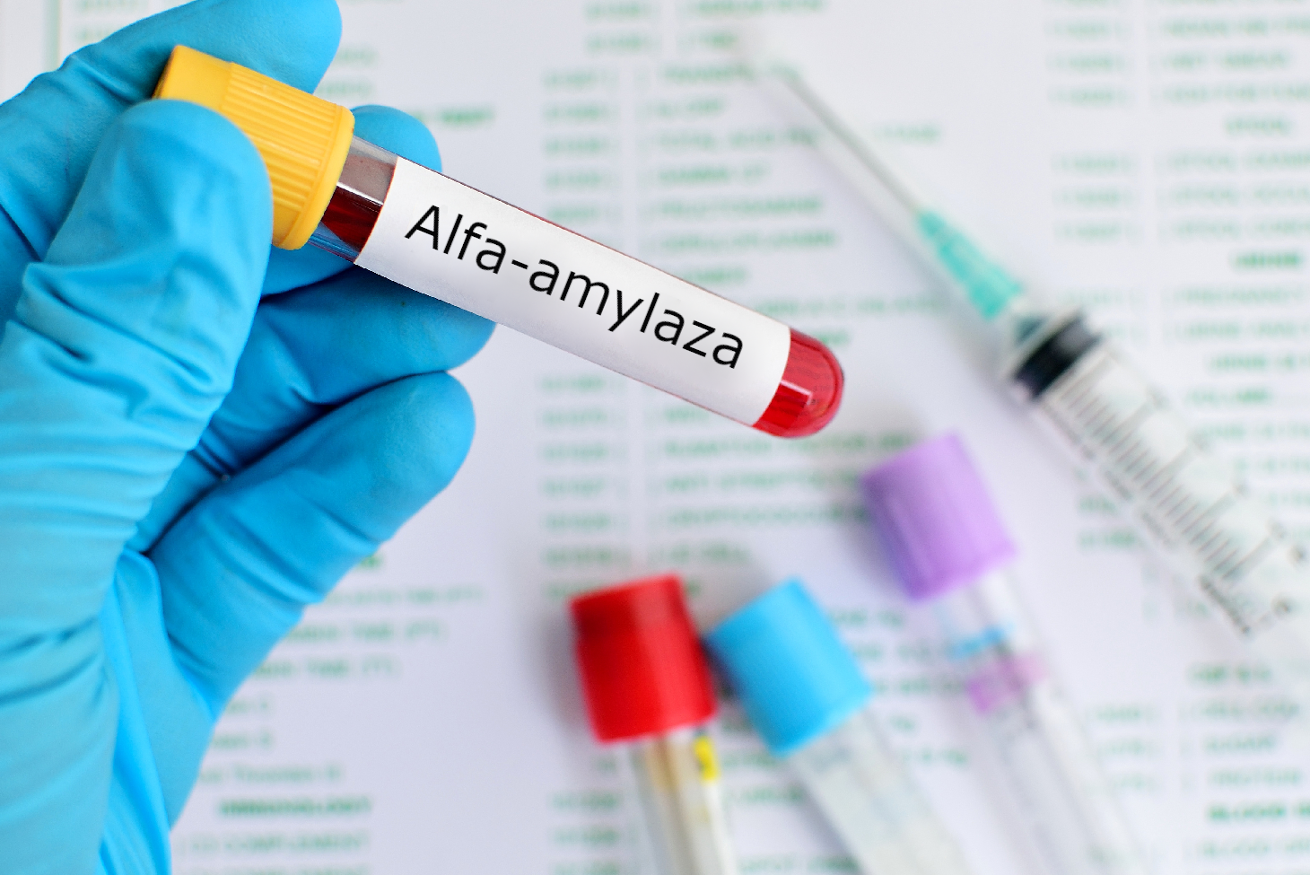 Alfa Amylaza — Na Czym Polega Badanie Wskazania Przygotowanie Normy I Interpretacja Wyników 4026