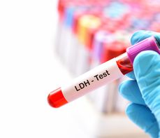 Dehydrogenaza mleczanowa (LDH) – co to jest? Normy, wskazania, przygotowanie
