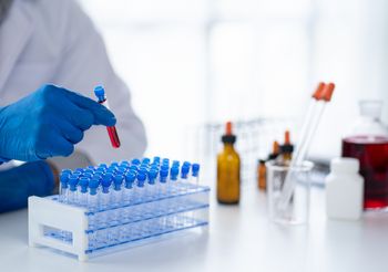 Hormon wzrostu, czyli somatotropina, jest syntetyzowany w przysadce mózgowej, a jego głównym zadaniem jest pobudzanie wzrostu kości i produkcji różnego rodzaju białek. /Fot. Adobe Stock