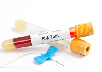 Badanie prostaty oraz antygenu PSA to podstawowe elementy profilaktyki nowotworu prostaty. /Fot. Adobe Stock