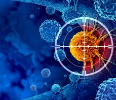 Diagnostyka nowotworów – metody, wskazania, przygotowanie do badań