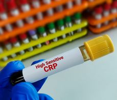 Hs CRP – na czym polega badanie? Normy, wskazania, przygotowanie