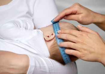 Objawem wodogłowia u niemowlaka może być widoczny gołym okiem zwiększony, nieproporcjonalny rozmiar głowy.