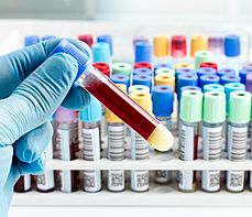 Proste badanie wykrywa 8 rodzajów raka. Przełom w diagnostyce nowotworów?
